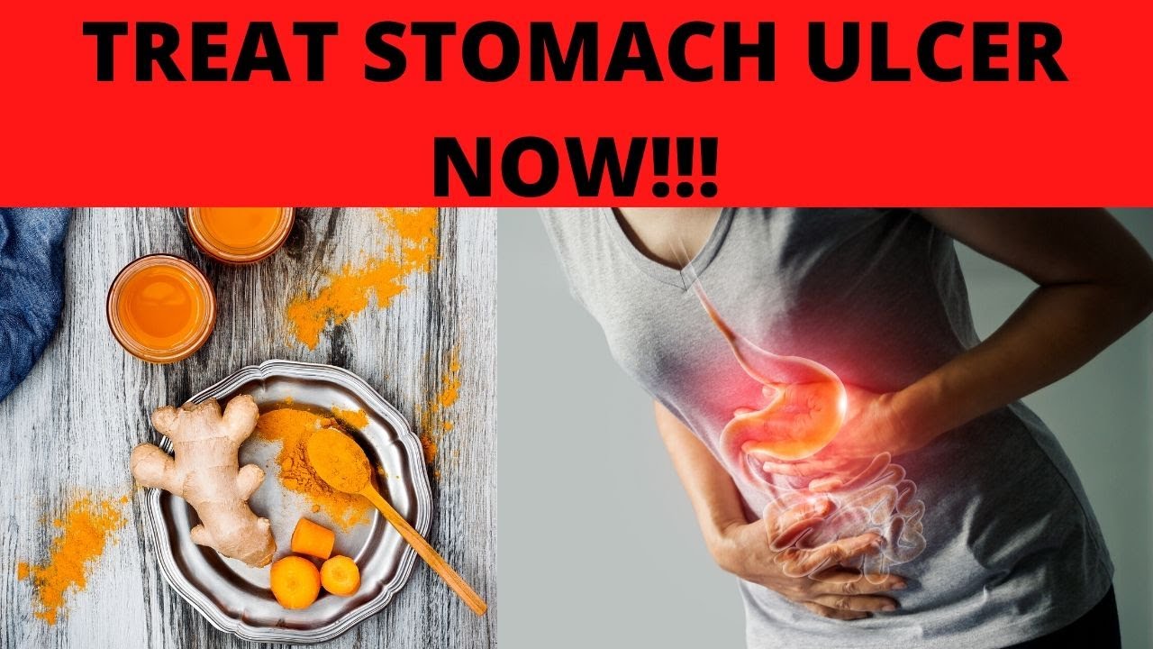 Stomach Ulcer Treatment At Home Youtube