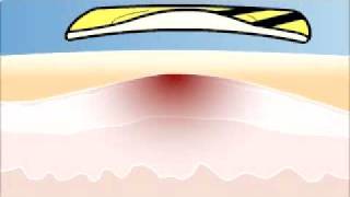Bee_Patch_01.avi