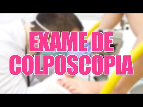 Vídeo: Por Que Eu Preciso De Uma Biópsia Dirigida Por Colposcopia?