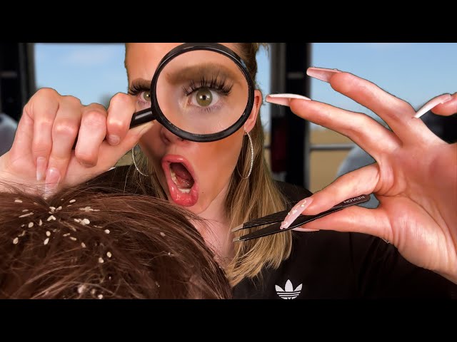 ASMR British chav removes your LICE (scalp massage) 🔎🪳