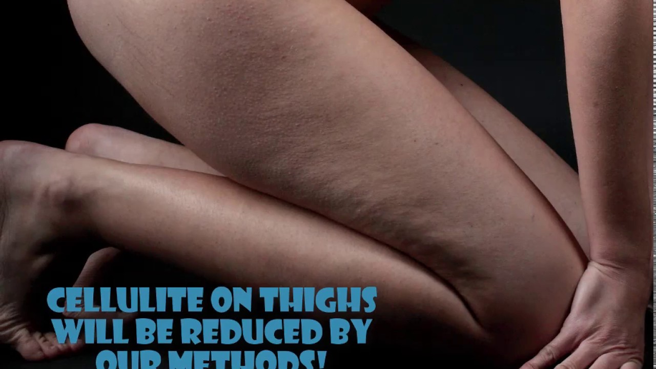 Does Biking Get Rid Of Cellulite - YouTube