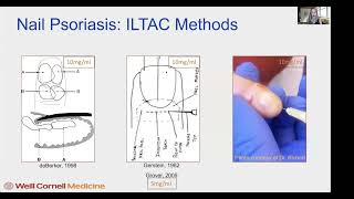 Global Dermatology Talks 6-6-022 Dr. Shari Lipner