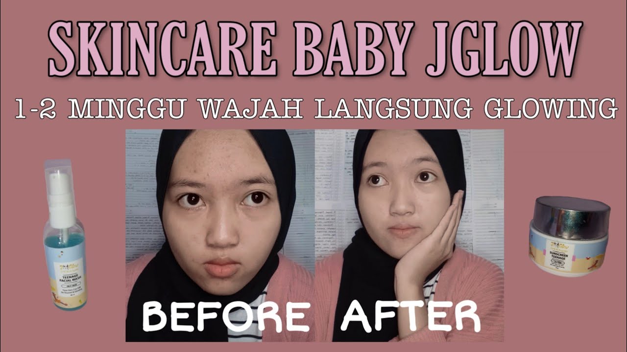 GLOWING SEKETIKA!!! REVIEW SKINCARE BABY JGLOW YouTube