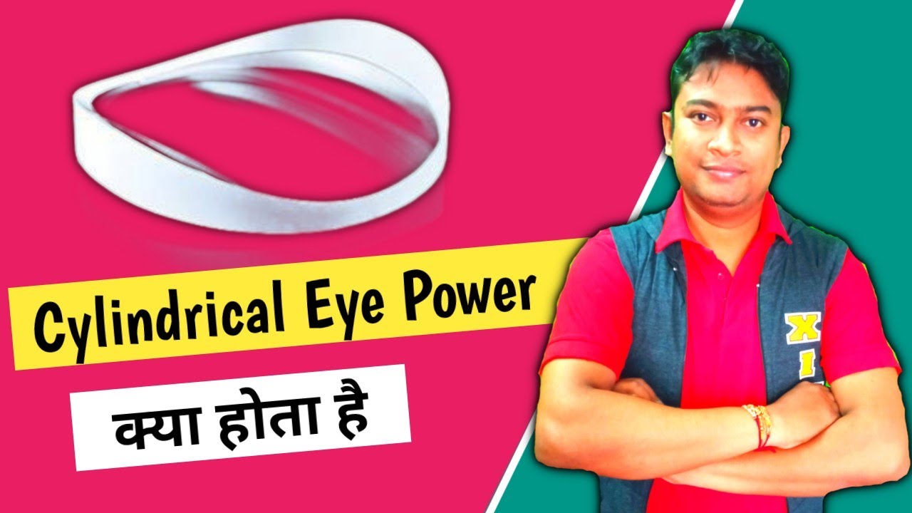 buurman twaalf Renovatie Cylindrical power in eye means in hindi | cylindrical power kya hota hai | cylindrical  lens - YouTube