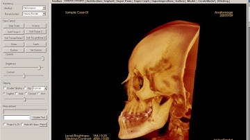 05   Changing volume rendering options  InVivoDental Training Videos