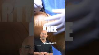 Partial vs. Total Knee Replacement: What’s the Big Difference?