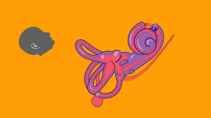 Understand BPPV in One Minute - Michael Teixido, M.D.