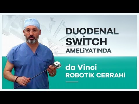 "da Vinci Robotik Cerrahi" Sistemiyle Duodenal Switch Ameliyatı Prof. Dr. Mahir Özmen