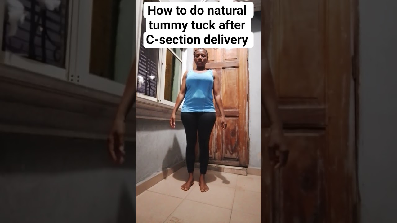 Flat tummy after C-section delivery, try this tummy tuck exercise for belly pouch 