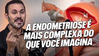 A Endometriose Vai Muito Além da Dor