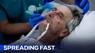 Aggressive Lung Cancer Forces Emergency Surgery on 75-Year-Old | Hospital