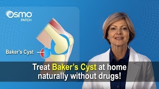 Baker's Cyst Treatment  What you need to know!