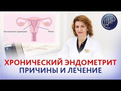 Хронический эндометрит: причины и лечение. Акушер-гинеколог ЦИР Дементьева С.Н.