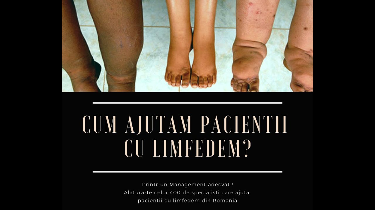 Pierde grăsime de șorț - prym-fashion.ro
