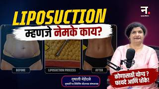 Liposuction म्हणजे काय? | फायदे, तोटे आणि Truth