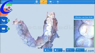 Full Jaw Intraoral Scan Medical Mecan