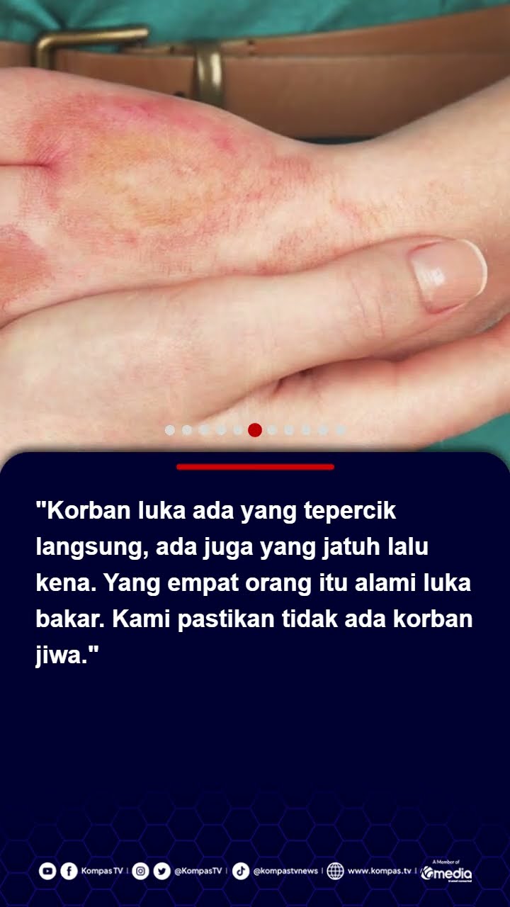 Tumpahan Cairan Kimia dari Truk Tangki di Bandung Barat Lukai 104 Orang #shorts
