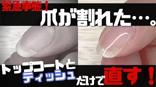 爪が割れた時の対処法！ティッシュで割れ爪補修？！強度は？簡単？検証しました♪