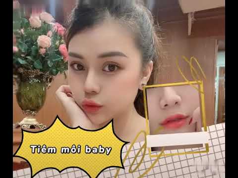 Video Tiêm môi baby | Cherry Nguyễn .Vn - youtube