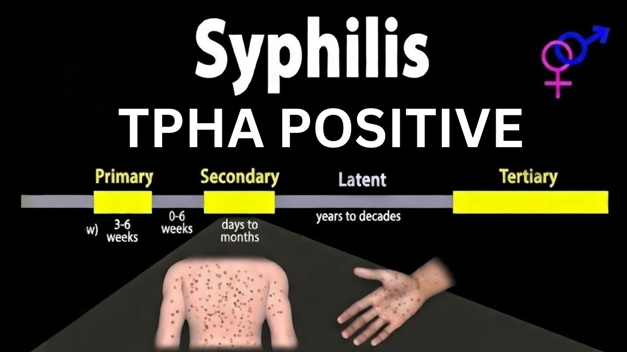 TPHA TEST Kya Hota Hai | TPHA Positive Symptoms Treatment | TPHA Negative Kaise Hota Hai | Syphilis