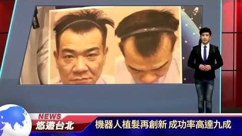 机器人植发再创新 成功率高达九成 - 天天要闻