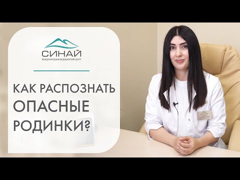 🔍 Дерматоскопия - как и когда проводится, признаки опасных родинок. Дерматоскопия как проводится.12+