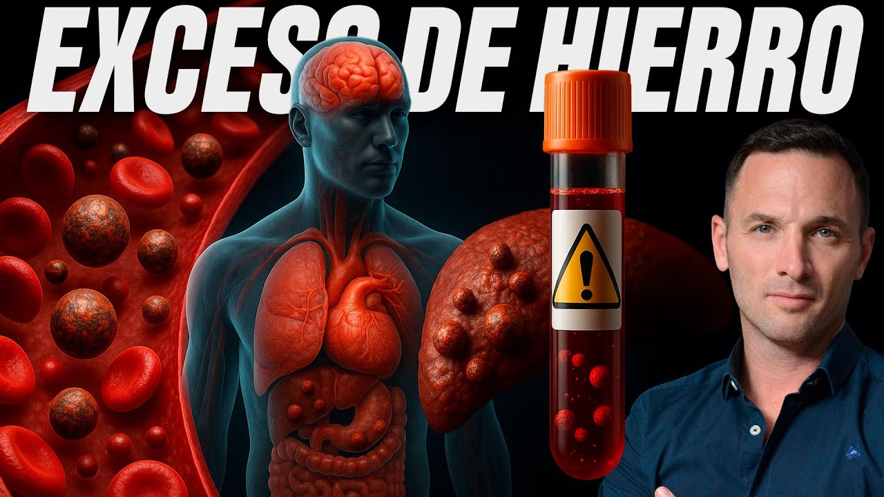 El Exceso de HIERRO daña tu Cuerpo | ESTOS SON LOS SÍNTOMAS (Ferritina Alta)