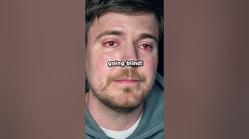 We Saved MrBeast From Going BLIND 😱