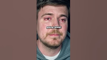 We Saved MrBeast From Going BLIND 😱