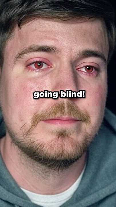 We Saved MrBeast From Going BLIND 😱