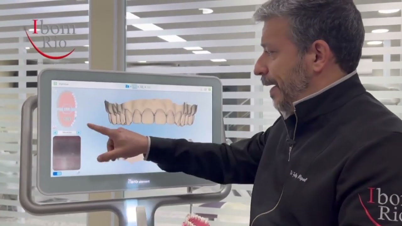 Aprenda a usar o Scanner Intraoral iTero dentro da Implantodontia