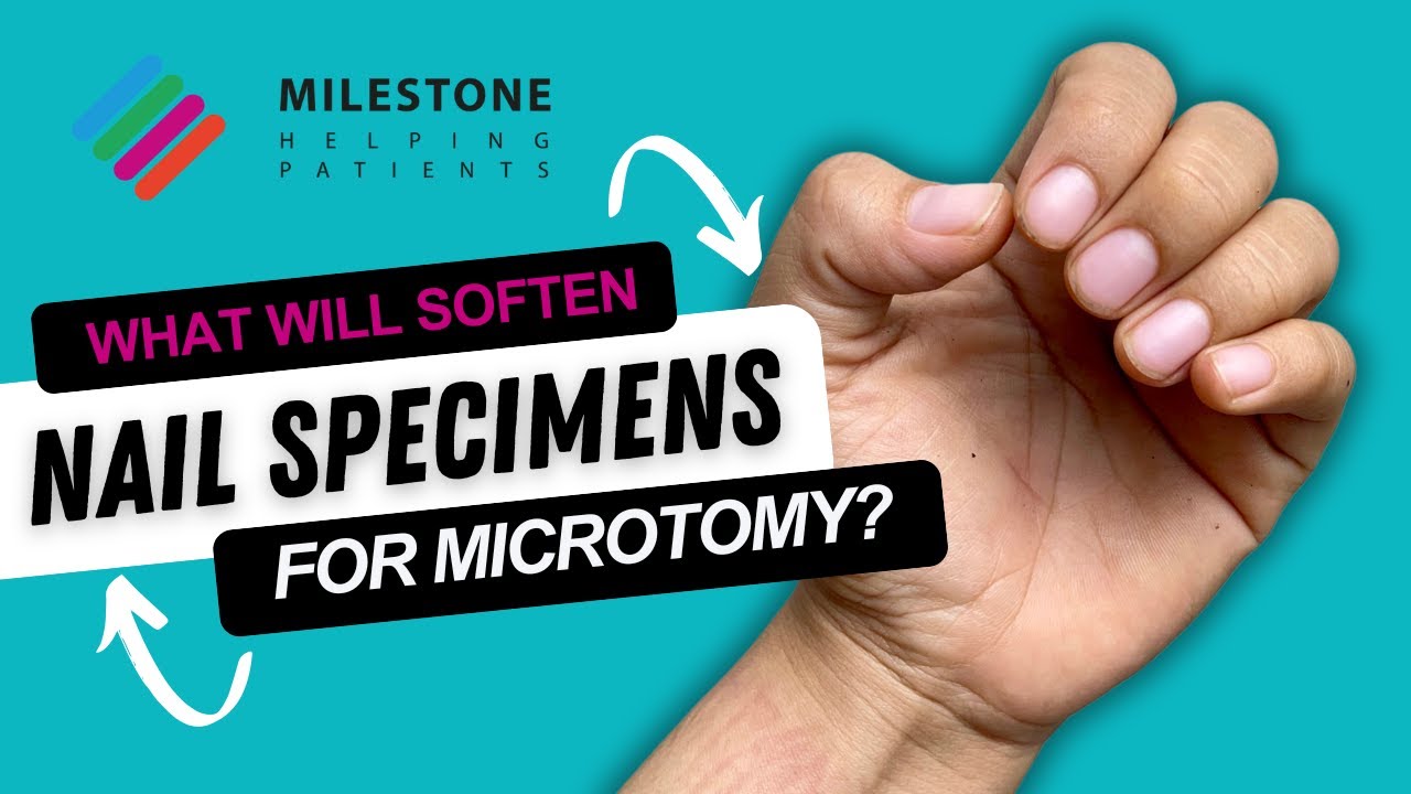 Best Way to Soften Nail Specimens for Microtomy (We Tested 4 Methods!)