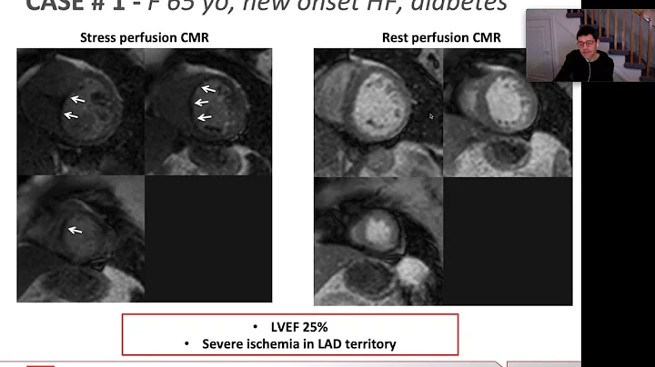 Imaging for the cardiac surgeon part 1 Mongeon