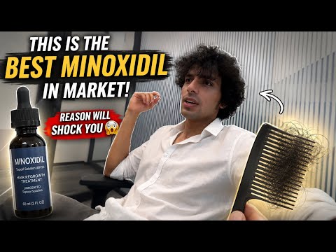 This Minoxidil Is Better Than 99% In The Market 😳 (Reason Will Shock You)”