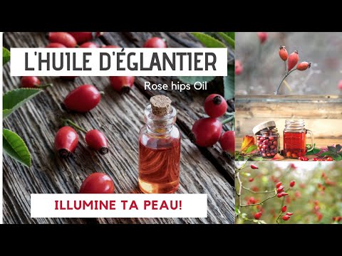 Vidéo: Haie D'églantier - Belle Protection