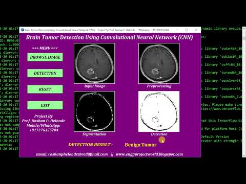 CNN Based Brain Tumor Detection Using Convolutional Neural Network  Python Project With Source Code