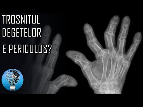Video: Ce înseamnă atunci când un tip te ține de mână în timp ce împletește degetele?