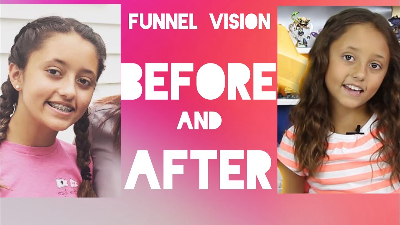Funnel Vision Before And After Youtube