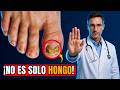 Si tu uña del pie está AMARILLA y GRUESA… NO es solo un hongo (tu cuerpo te está avisando)