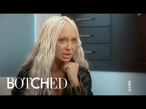 Did Woman Get Sheep's Fat Injected in Lips?! | Botched | E!