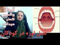 عمل لوزه در کودکان دکتر ژیلا محمدی آذر 