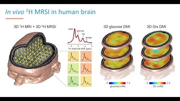 KIS - Prof. Jeanine Prompers - Metabolic MRI towards clinical translation
