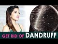 How to Get Rid of Dandruff | Scalp Revealing Hairstyles | Knot Me Pretty