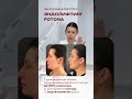 Эндолифтинг в Новосибирске