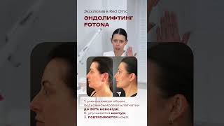 Эндолифтинг в Новосибирске