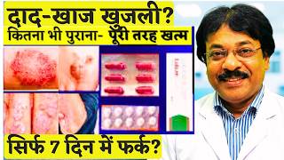 दाद-खाज खुजली जड़ से खत्म😱| Top 3 Best Medicine for Fungal Infection | Dad Khaj Khujli Ki Dava 2026