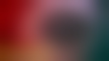 Management of Subluxated Lens with capsular tension segment CTS and capsular tension ring CTR