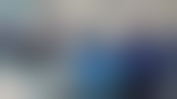 Robotic radical prostatectomy explained | Professor Declan Murphy