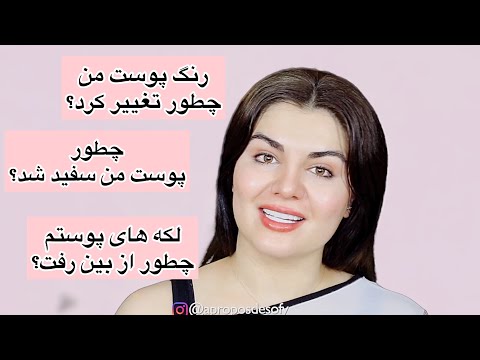 🥰پاسخ به سوالهای شما در مورد تغییر پوست من😉 قلیه میگو هم‌درست میکنیم😁