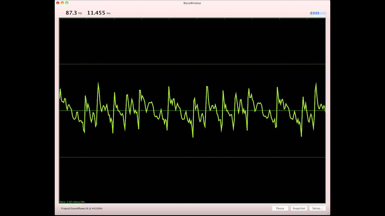 Understanding Oscilloscope Waveforms at Shelly Cervantes blog